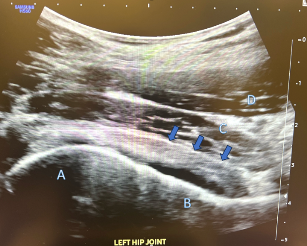 Anterior Hip