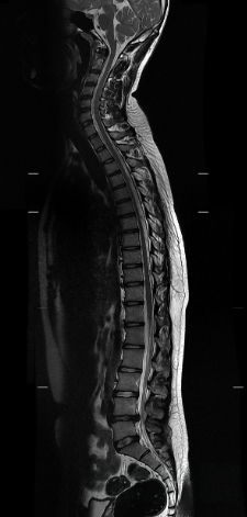 A Shock Down the Leg