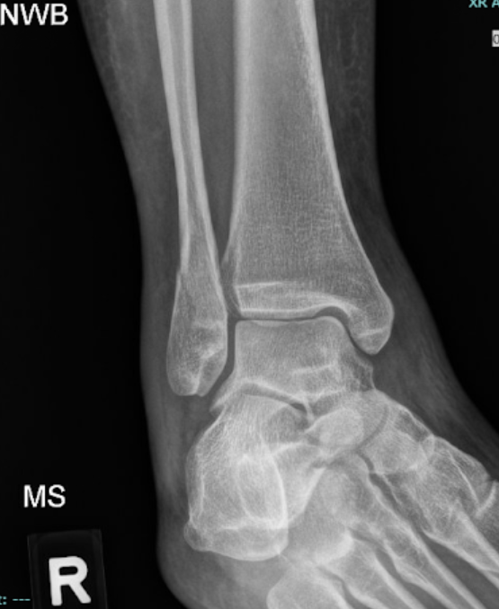 Dancing Till You Drop 