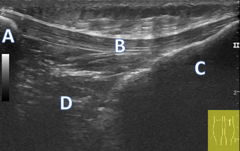 Inferior Knee
