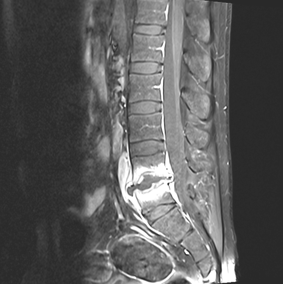 It’s all Spine