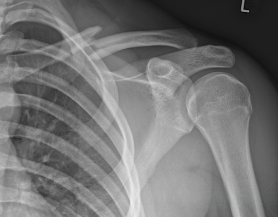 One Wheelin' and Dealin'