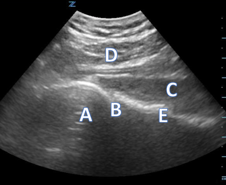 Posterior Shoulder