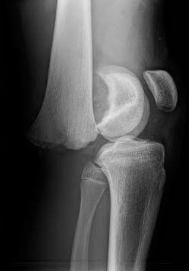 Stop Saltering That Harris