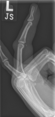 The Middle Finger