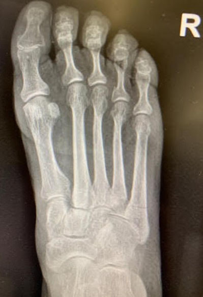 This Little Piggy Went to the Hospital